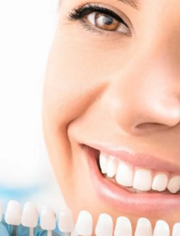 Zahnbleaching-Verfahren – für strahlend weisses Lächeln